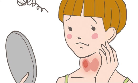 子どもがなりやすい甲状腺の病気には、どんなものがあるでしょう
